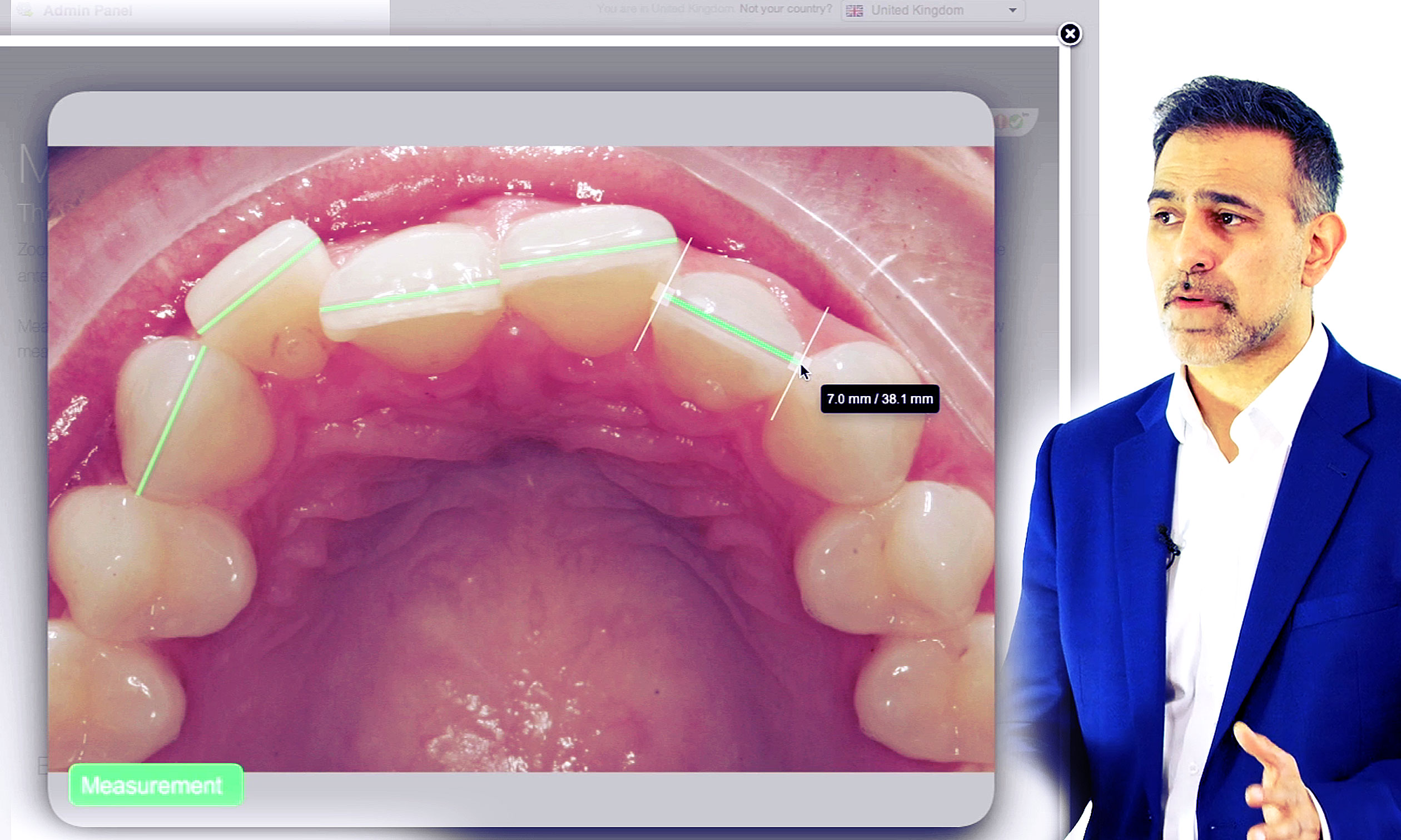 Lingual Brace Course